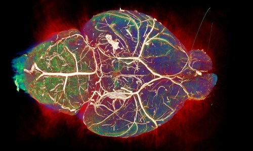 False colour image of a brain