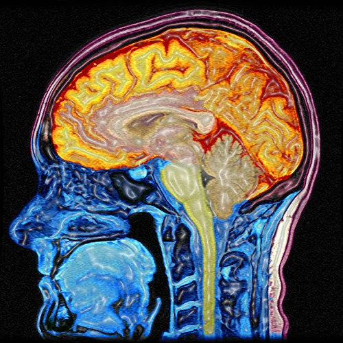 False colour sagittal section of head and brain